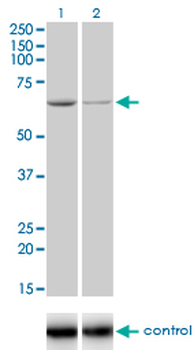 ADPGK monoclonal antibody (M01), clone 1E4