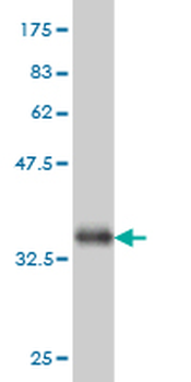 ADPGK monoclonal antibody (M01), clone 1E4