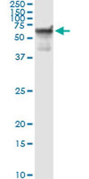 STK33 monoclonal antibody (M09), clone 1F10