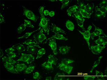 ACBD3 monoclonal antibody (M01), clone 2G2