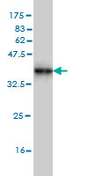 ACBD3 monoclonal antibody (M01), clone 2G2