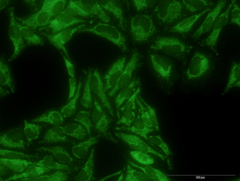 TOMM22 monoclonal antibody (M01J), clone 4G4