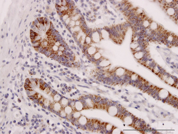 TOMM22 monoclonal antibody (M01J), clone 4G4