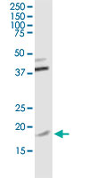 TOMM22 monoclonal antibody (M01J), clone 4G4