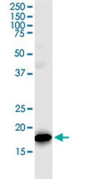 TOMM22 monoclonal antibody (M01J), clone 4G4