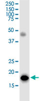 TOMM22 monoclonal antibody (M01J), clone 4G4