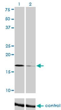 TOMM22 monoclonal antibody (M01J), clone 4G4