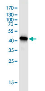 TOMM22 monoclonal antibody (M01J), clone 4G4