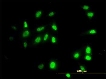 RAD18 monoclonal antibody (M01), clone 3H7