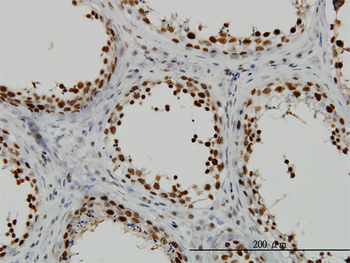 RAD18 monoclonal antibody (M01), clone 3H7