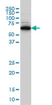 RAD18 monoclonal antibody (M01), clone 3H7