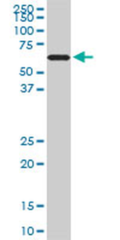 RAD18 monoclonal antibody (M01), clone 3H7