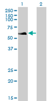 RAD18 monoclonal antibody (M01), clone 3H7