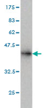 RAD18 monoclonal antibody (M01), clone 3H7