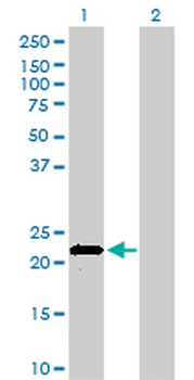 APOM monoclonal antibody (M01), clone 1F10