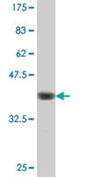 PNPO polyclonal antibody (A01)