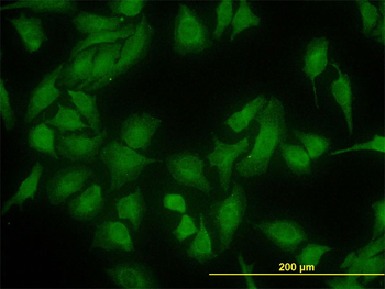 DNAJC10 monoclonal antibody (M01), clone 3C4