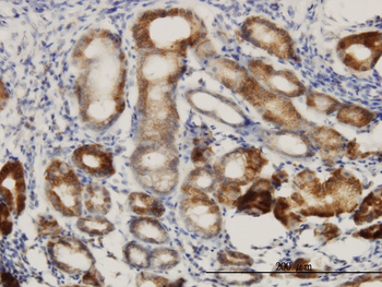 DNAJC10 monoclonal antibody (M01), clone 3C4