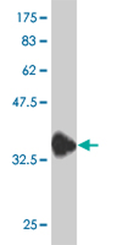 DNAJC10 monoclonal antibody (M01), clone 3C4