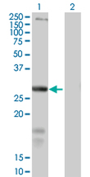 SLC39A3 purified MaxPab mouse polyclonal antibody (B01P)