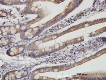 TIMM9 monoclonal antibody (M01), clone 1D6