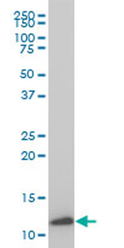 TIMM9 monoclonal antibody (M01), clone 1D6