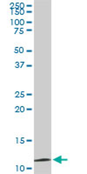 TIMM9 monoclonal antibody (M01), clone 1D6