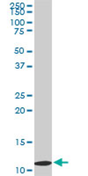 TIMM9 monoclonal antibody (M01), clone 1D6