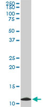 TIMM9 monoclonal antibody (M01), clone 1D6