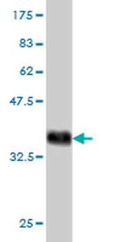 TIMM9 monoclonal antibody (M01), clone 1D6