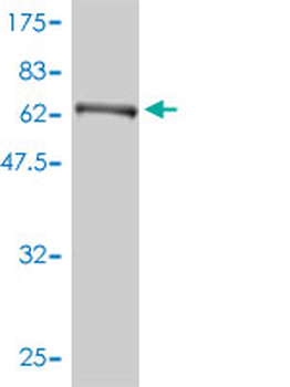 PHGDH monoclonal antibody (M01), clone 4A3-1D6