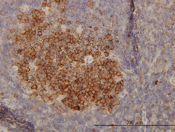 PHGDH monoclonal antibody (M01), clone 4A3-1D6