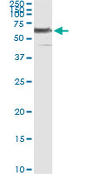 PHGDH monoclonal antibody (M01), clone 4A3-1D6