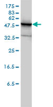 PHGDH monoclonal antibody (M01), clone 4A3-1D6