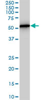 PHGDH monoclonal antibody (M01), clone 4A3-1D6