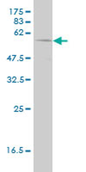 PHGDH monoclonal antibody (M01), clone 4A3-1D6