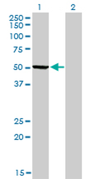 PHGDH monoclonal antibody (M01), clone 4A3-1D6