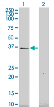 HEY1 monoclonal antibody (M02), clone 2F10