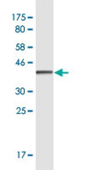 CUX2 monoclonal antibody (M03), clone 2H8