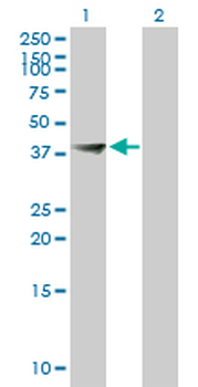 FBXO28 purified MaxPab mouse polyclonal antibody (B01P)