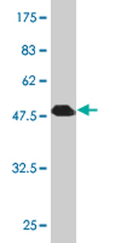 RRAS2 monoclonal antibody (M01), clone 2D3-4B8