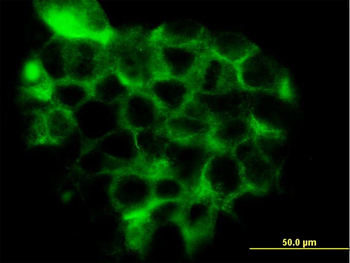 RRAS2 monoclonal antibody (M01), clone 2D3-4B8