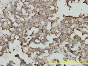 RRAS2 monoclonal antibody (M01), clone 2D3-4B8