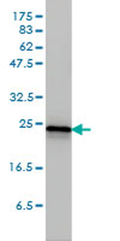 RRAS2 monoclonal antibody (M01), clone 2D3-4B8