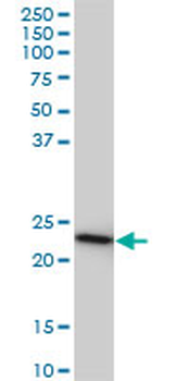 RRAS2 monoclonal antibody (M01), clone 2D3-4B8