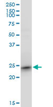 RRAS2 monoclonal antibody (M01), clone 2D3-4B8