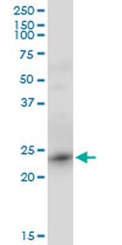 RRAS2 monoclonal antibody (M01), clone 2D3-4B8