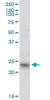 RRAS2 monoclonal antibody (M01), clone 2D3-4B8