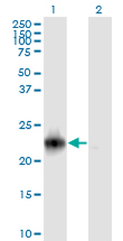 RRAS2 monoclonal antibody (M01), clone 2D3-4B8