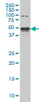 STK38 monoclonal antibody (M04), clone 2F3